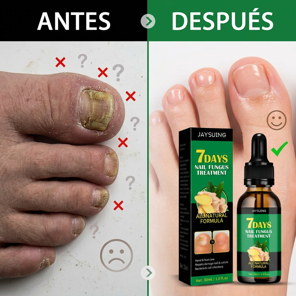 Aceite Anti Hongos Uñas - 7 Days™ 2UND 30ml 3