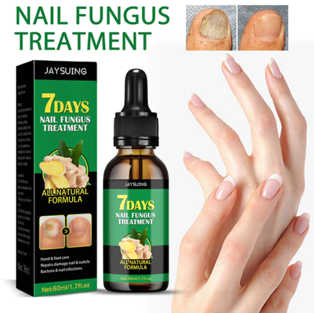 Compra 1 y llevate 2👋🦠Anti Hongos Uñas - 7 Days™  2UND 30ml