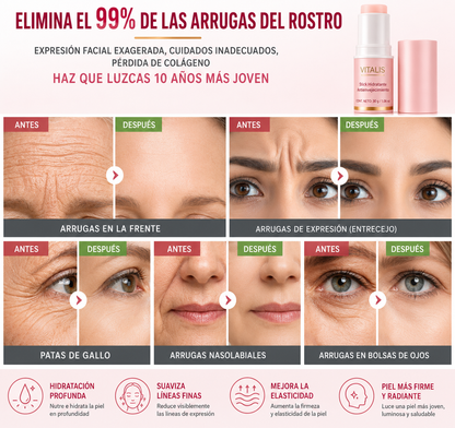 Compra 1 y llevate 2 Bálsamo antiarrugas
