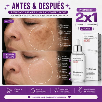 🧴Promoción 2 por 1 - Serum Facial con Nicotinamida 🧪 x 2 UNIDADES💧🌟