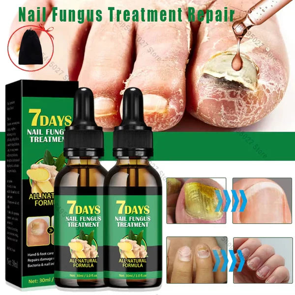 Compra 1 y llevate 2👋🦠Anti Hongos Uñas - 7 Days™  2UND 30ml