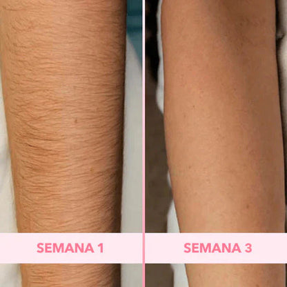 ⚡💡50% OFF ⚡💡 Depiladora Láser IPL Suavidad Láser en Casa