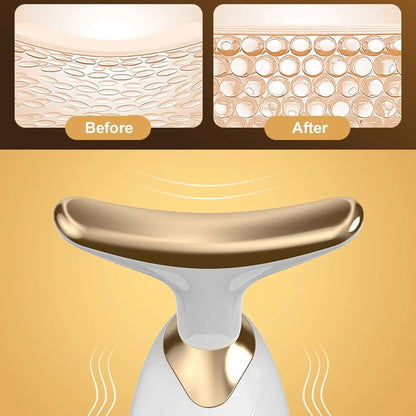 Elevador Facial Delfín LED | Lifting y Belleza Facial en Casa ⭐
