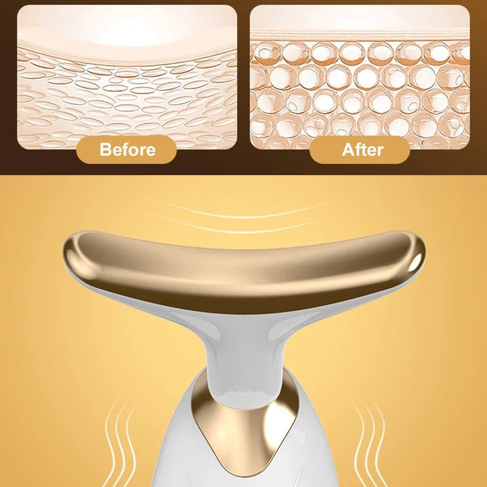 Elevador Facial Delfín LED | Lifting y Belleza Facial en Casa