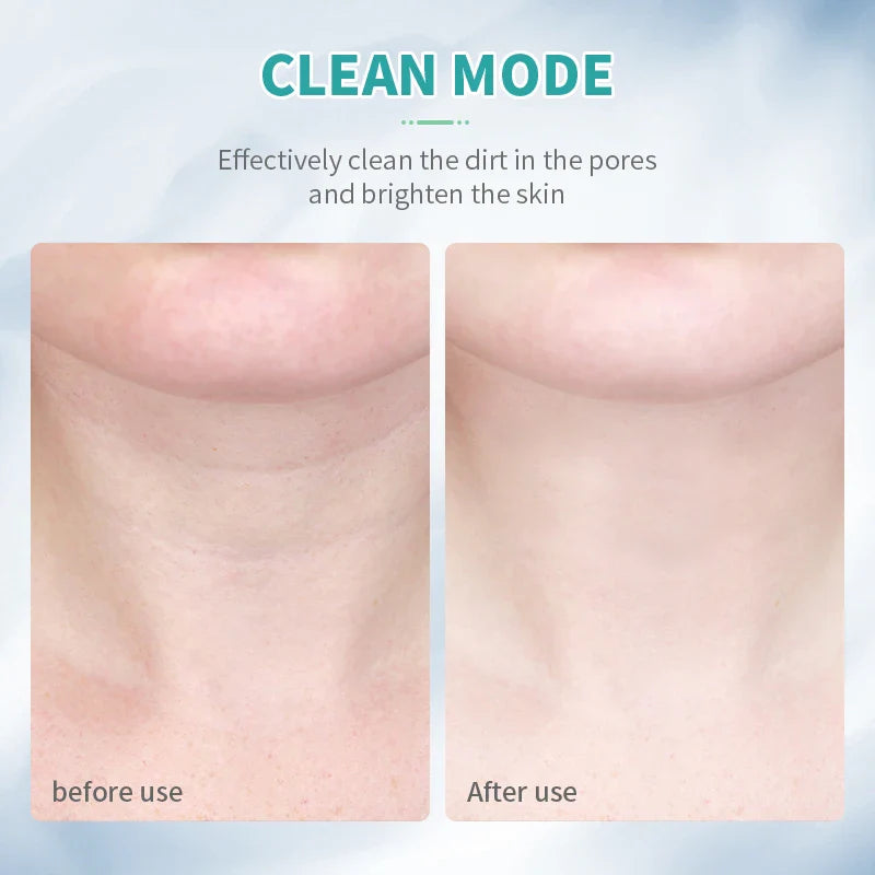 Elevador Facial Delfín LED | Lifting y Belleza Facial en Casa