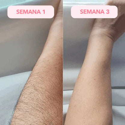 ⚡💡50% OFF ⚡💡 Depiladora Láser IPL Suavidad Láser en Casa