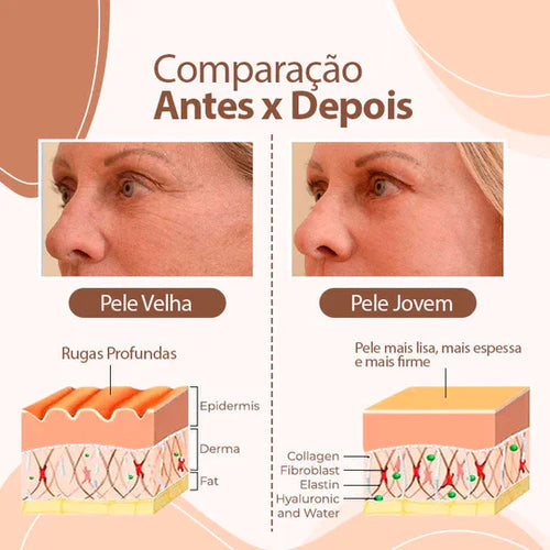 Compra 1 y llevate 2 Bálsamo antiarrugas