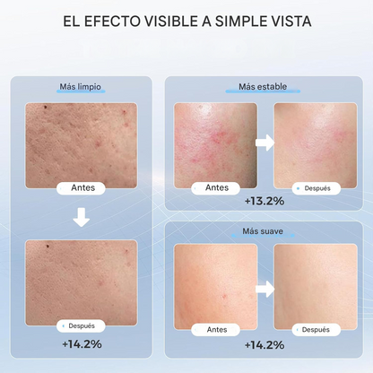 Máscara de Luz Roja Facial